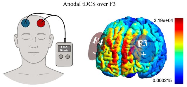 Figura del estudio sobre tDCS y resiliencia
