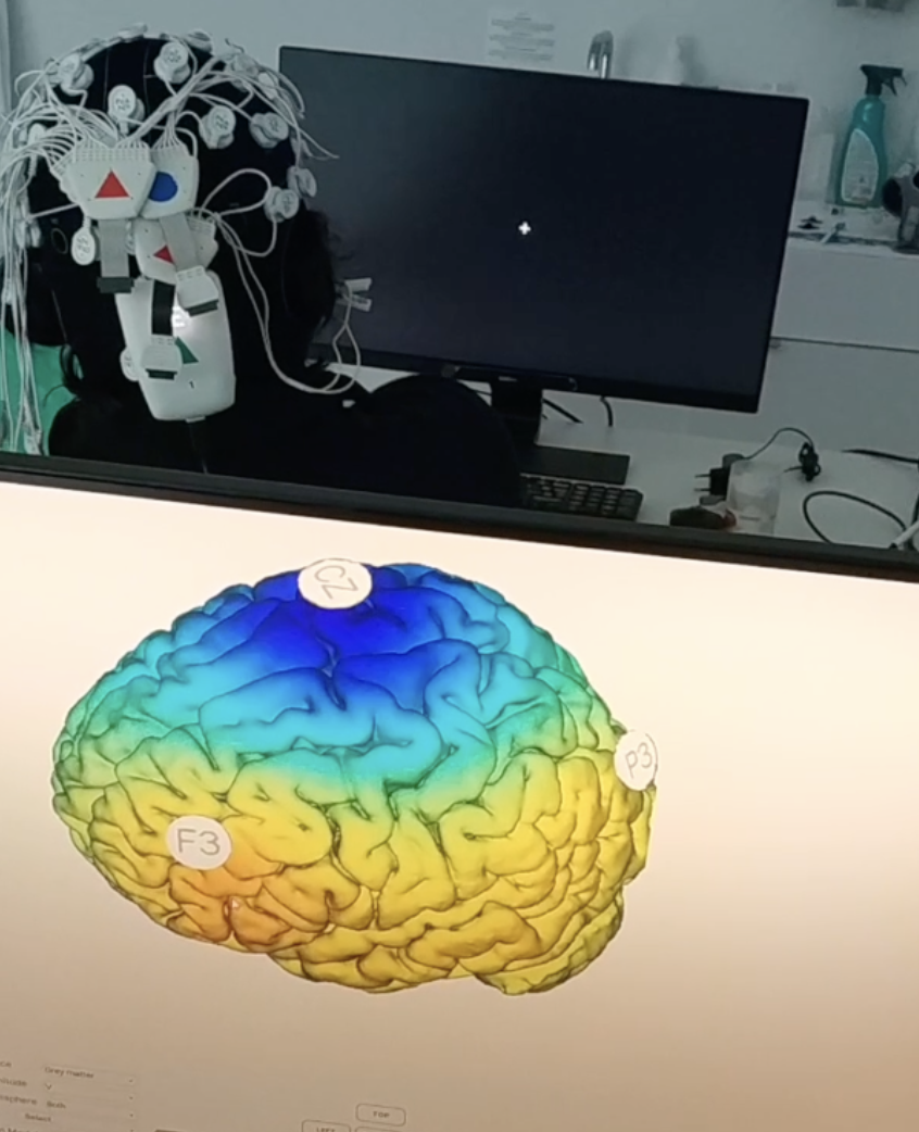 Figura del estudio sobre estimulación cerebral tACS