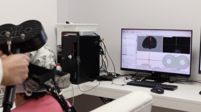 Figura del estudio sobre tDCS domiciliaria en depresión resistente